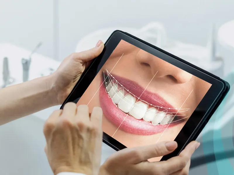 Progettazione digitale del sorriso su tablet